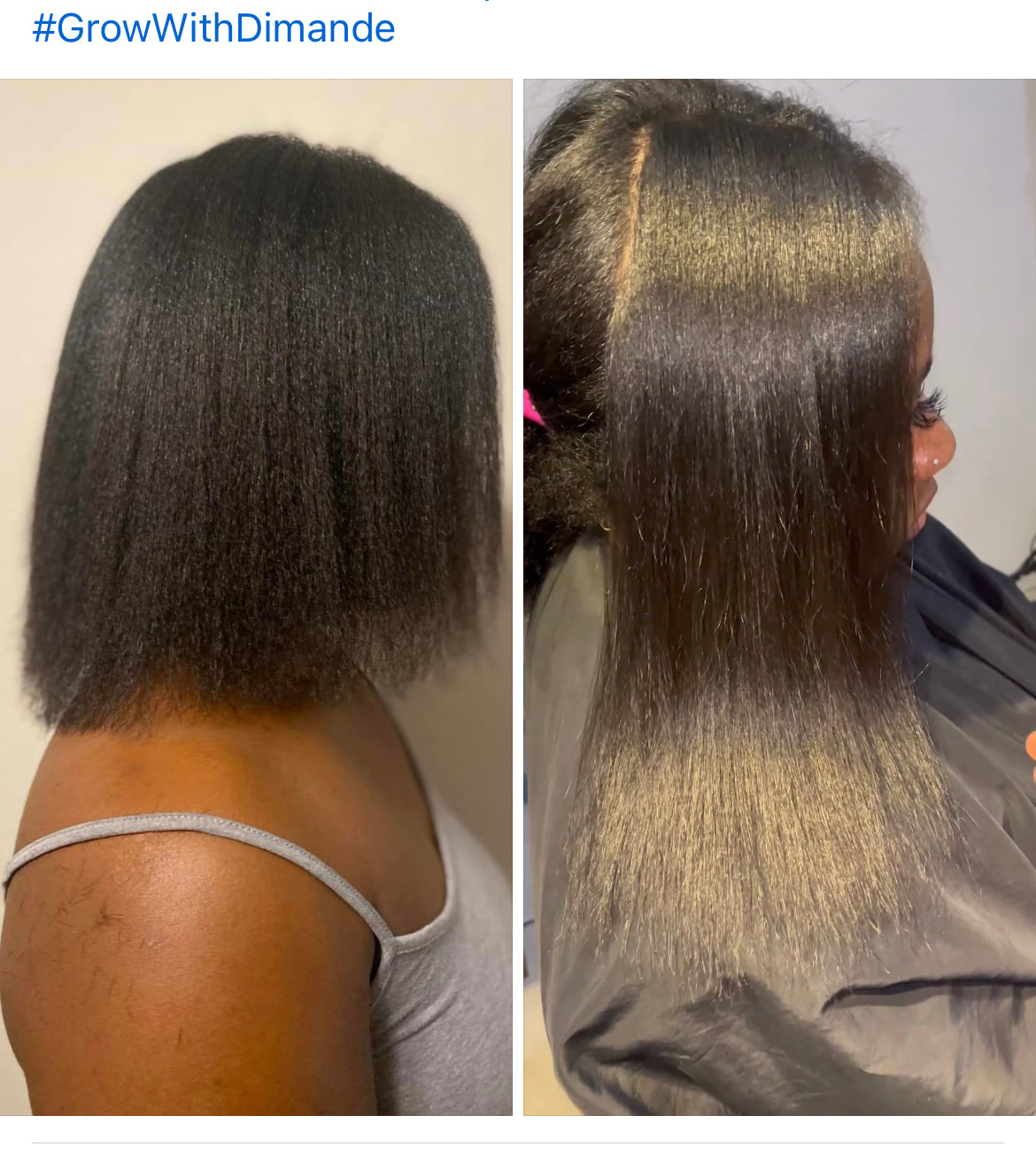Fenugreek Scalp Tonic